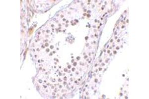 Immunohistochemical staining of human testis tissue with 10 ug/mL MED4 polyclonal antibody .