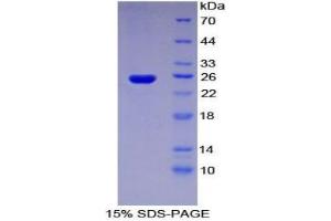 SDS-PAGE analysis of Human Sprouty Homolog 3 Protein. (SPRY3 Protéine)