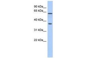 Image no. 1 for anti-ERG, ETS transcription factor (ERG) (AA 360-409) antibody (ABIN6741408) (ERG anticorps  (AA 360-409))