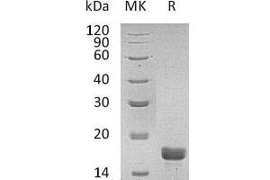 Western Blotting (WB) image for Interleukin 2 (IL2) (Active) protein (ABIN7320817) (IL-2 Protéine)