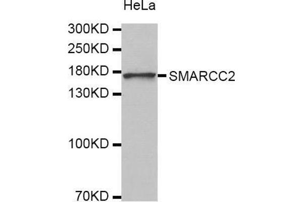 SMARCC2 antibody  (AA 150-250)