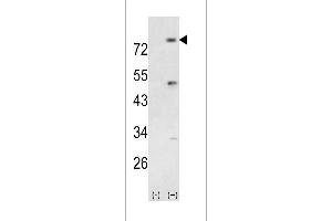Western blot analysis of PIK3R5 (arrow) using rabbit polyclonal PIK3R5 Antibody (Center) (ABIN392579 and ABIN2842114). (PIK3R5 anticorps  (AA 392-421))