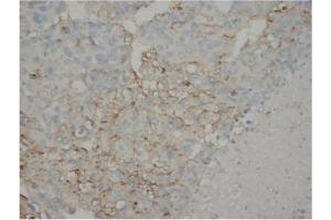 Immunohistochemistry (IHC) image for anti-alpha-Fetoprotein (AFP) antibody (ABIN1105327)