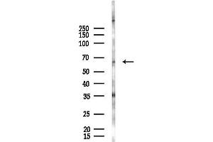Western blot analysis of lysates from Hela cells(starvation 24h treatment), using Acetyl-FOXO3A (Lys290) Antibody at 1/1000 dilution.
