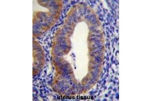 FGD6 Antibody (C-term) immunohistochemistry analysis in formalin fixed and paraffin embedded human uterus tissue followed by peroxidase conjugation of the secondary antibody and DAB staining. (FGD6 anticorps  (C-Term))