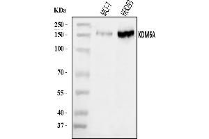 Western blot analysis of UTX/KDM6A using anti-UTX/KDM6A antibody (ABIN7601589).