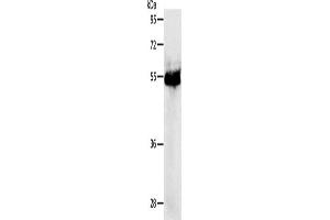Western Blotting (WB) image for anti-Protein Kinase, CAMP-Dependent, Regulatory, Type I, beta (PRKAR1B) antibody (ABIN2426823) (PRKAR1B anticorps)