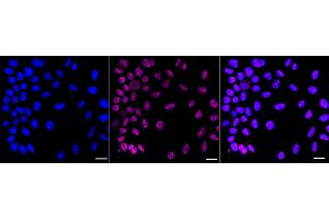 anti-Oligodendrocyte Transcription Factor 3 (OLIG3) antibody