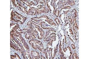 IHC analysis of HSPH1 using anti-HSPH1 antibody (ABIN7602237). (HSPH1 anticorps  (AA 653-858))