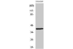 Western Blotting (WB) image for anti-Distal-Less Homeobox 4 (DLX4) (Internal Region) antibody (ABIN3184316) (DLX4 anticorps  (Internal Region))