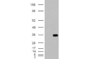 Image no. 2 for anti-Hydroxyacyl-CoA Dehydrogenase (HADH) (Internal Region) antibody (ABIN374901) (HADH anticorps  (Internal Region))