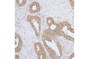 Immunohistochemistry (IHC) image for anti-Aminoacyl tRNA Synthetase Complex-Interacting Multifunctional Protein 1 (AIMP1) (AA 262-312) antibody (ABIN7455058) (AIMP1 anticorps  (AA 262-312))