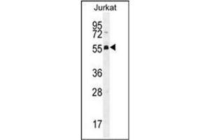 Western blot analysis of PODNL1 Antibody (Center) Cat. (PODNL1 anticorps  (Middle Region))