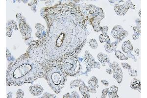 IHC analysis of Filamin B/FLNB using anti-Filamin B/FLNB antibody (ABIN7601607).