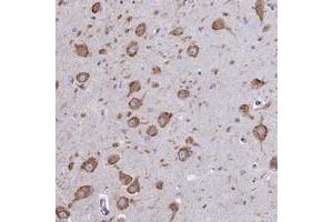 Immunohistochemical staining of human hippocampus with WDR35 polyclonal antibody  shows strong cytoplasmic positivity in neurons. (WDR35 anticorps)