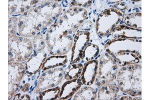 Immunohistochemical staining of paraffin-embedded Kidney tissue using anti-ATP5B mouse monoclonal antibody. (ATP5B anticorps)
