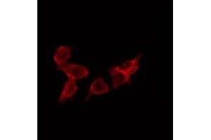 ABIN6275080 staining Hela by IF/ICC. (DNAJC5 anticorps  (Internal Region))