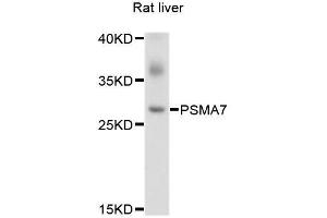 Western blot analysis of extracts of rat liver, using PSMA7 antibody. (PSMA7 anticorps  (AA 1-248))