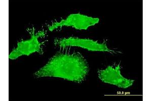 Immunofluorescence of monoclonal antibody to RDX on HeLa cell.