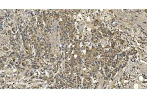 IHC analysis of RGS6 using anti-RGS6 antibody (ABIN7602326). (RGS6 anticorps  (AA 7-357))