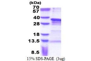 SDS-PAGE (SDS) image for Paired Related Homeobox 1 (PRRX1) (AA 1-217) protein (His tag) (ABIN5853292) (PRRX1 Protein (AA 1-217) (His tag))