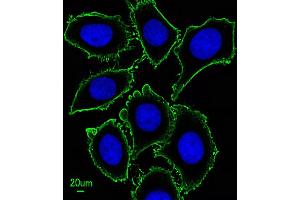 Immunofluorescent analysis of  cells, using KIT Antibody (ABIN1882197 and ABIN2843885).
