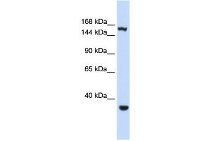 WB Suggested Anti-EIF4G3 Antibody Titration:  0. (EIF4G3 anticorps  (Middle Region))