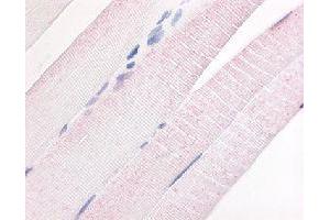 Immunohistochemical (Formalin/PFA-fixed paraffin-embedded sections) staining in human skeletal muscle with PDE7A polyclonal antibody .