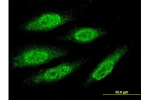 Immunofluorescence of monoclonal antibody to MAGEA8 on HeLa cell. (MAGEA8 anticorps  (AA 1-318))
