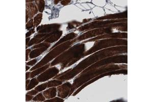 Immunohistochemical staining (Formalin-fixed paraffin-embedded sections) of human skeletal muscle with MYH6 monoclonal antibody, clone CL2148  shows strong cytoplasmic immunoreactivity in striated muscle fibers.