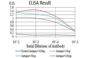 Black line: Control Antigen (100 ng),Purple line: Antigen (10 ng), Blue line: Antigen (50 ng), Red line:Antigen (100 ng)