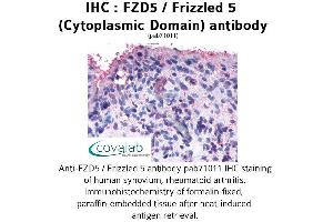 Image no. 1 for anti-Frizzled Family Receptor 5 (FZD5) (3rd Cytoplasmic Domain) antibody (ABIN1734503) (FZD5 anticorps  (3rd Cytoplasmic Domain))