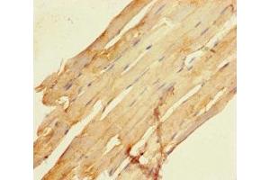 Immunohistochemistry of paraffin-embedded human skeletal muscle tissue using ABIN7168727 at dilution of 1:100 (SCAMP3 anticorps  (AA 2-170))