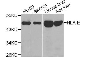 Western blot analysis of extracts of various cells, using HLA-E antibody. (HLA-E anticorps)
