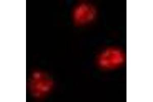 Immunofluorescent analysis of FIR staining in Hela cells. (FARP2 anticorps)