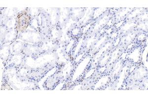 Detection of GAL1 in Bovine Kidney Tissue using Polyclonal Antibody to Galectin 1 (GAL1)