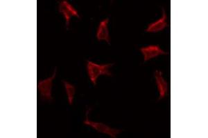 ABIN6269293 staining HeLa by IF/ICC. (RPS6 anticorps  (C-Term))