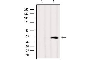 Western blot analysis of extracts from Mouse brain, using CAPZA1 Antibody. (CAPZA1 anticorps  (Internal Region))