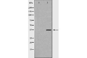 Western blot analysis of Hela whole cell lysates, using PSMD7 Antibody. (PSMD7 anticorps  (C-Term))