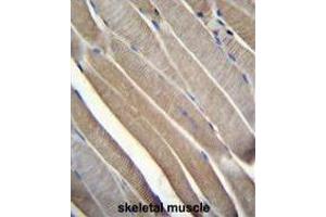 TRMT2B Antibody (N-term) immunohistochemistry analysis in formalin fixed and paraffin embedded human skeletal muscle followed by peroxidase conjugation of the secondary antibody and DAB staining.