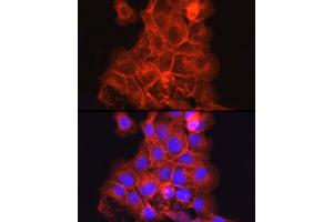 Immunohistochemistry of paraffin-embedded human placenta using THBD Rabbit pAb (ABIN1683026, ABIN3018621, ABIN3018622 and ABIN6220518) at dilution of 1:25 (40x lens).