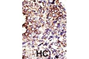 Immunohistochemistry (IHC) image for anti-Glucosaminyl (N-Acetyl) Transferase 1, Core 2 (GCNT1) antibody (ABIN3001515)