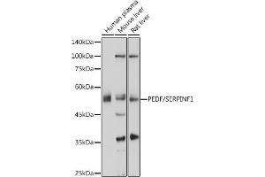 Western blot analysis of extracts of various cell lines, using PEDF/PEDF/SERPINF1 antibody (ABIN6131334, ABIN6147606, ABIN6147607 and ABIN6215471) at 1:1000 dilution. (PEDF anticorps  (AA 1-200))