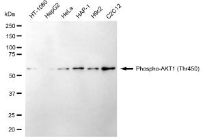 Western blotting analysis using phospho-AKT1 (Thr450) antibody (ABIN7800787).