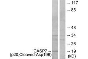 Western blot analysis of extracts from Jurkat cells, treated with etoposide 25uM 24h, using Caspase 7 (p20,Cleaved-Asp198) Antibody. (Caspase 7 anticorps  (Cleaved-Asp198))