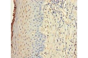 Immunohistochemistry of paraffin-embedded human tonsil tissue using ABIN7156855 at dilution of 1:100 (IL22 Receptor alpha 1 anticorps  (AA 250-573))