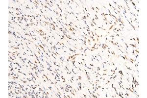 ABIN6267283 at 1/100 staining human TB tissue sections by IHC-P.