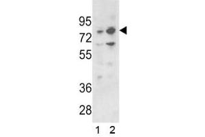 Western blot analysis of PLZF antibody and 1) 293 and 2) K562 lysate (ZBTB16 anticorps  (AA 637-666))