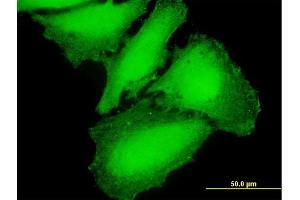 Immunofluorescence of purified MaxPab antibody to CAMK2G on HeLa cell.
