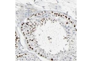 Immunohistochemical staining of human testis with SAGE1 polyclonal antibody  shows strong nuclear positivity in cells in seminiferus ducts. (SAGE1 anticorps)